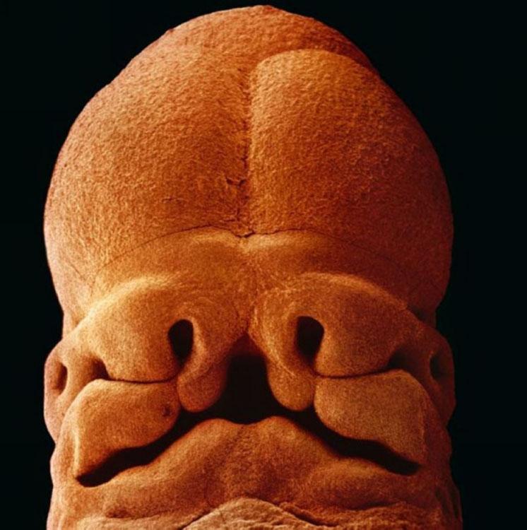 Five weeks. The embryo is approximately 9mm long. A face develops, with openings for the mouth, the nostrils and eyes. In 1965, Swiss photographer Lennart Nilsson took a series of pictures of developing embryos which were published on Life magazine. Within days, the entire print run of eight million had sold out. Those remarkable pictures have been collected in a large hardcover book, “A Child Is Born,�?according to reports of British newspaper Telegraph. (Photo Source: sina.com)