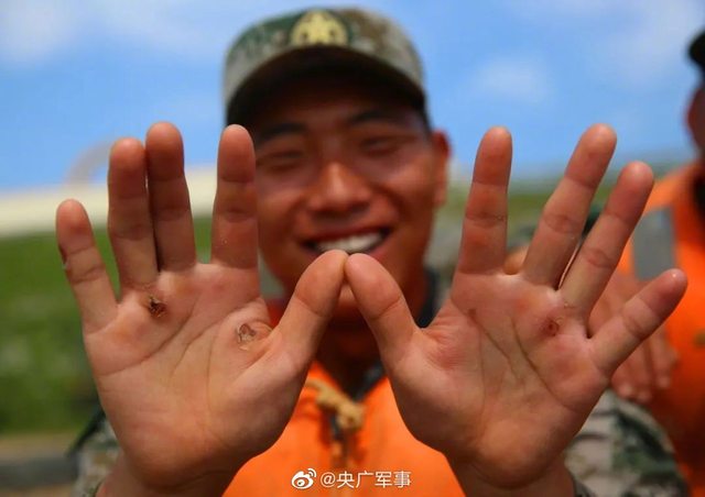 勋章|这样的脸、手、脚……都是你们最帅的样子