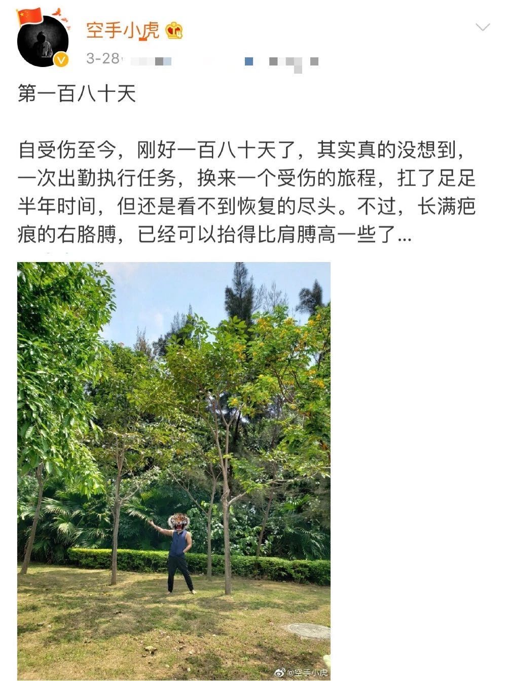 港警“小虎Sir”解开纱布的这幕，太心疼！