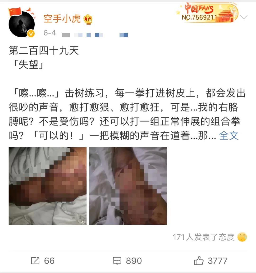 港警“小虎Sir”解开纱布的这幕，太心疼！