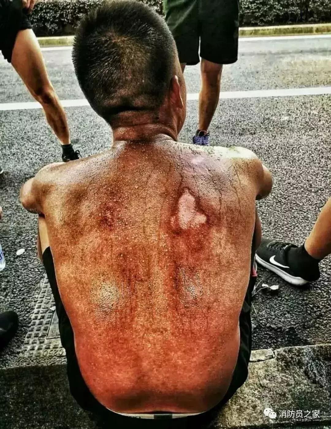 致敬!2018年最美逆行者的感人瞬间 请为他们点