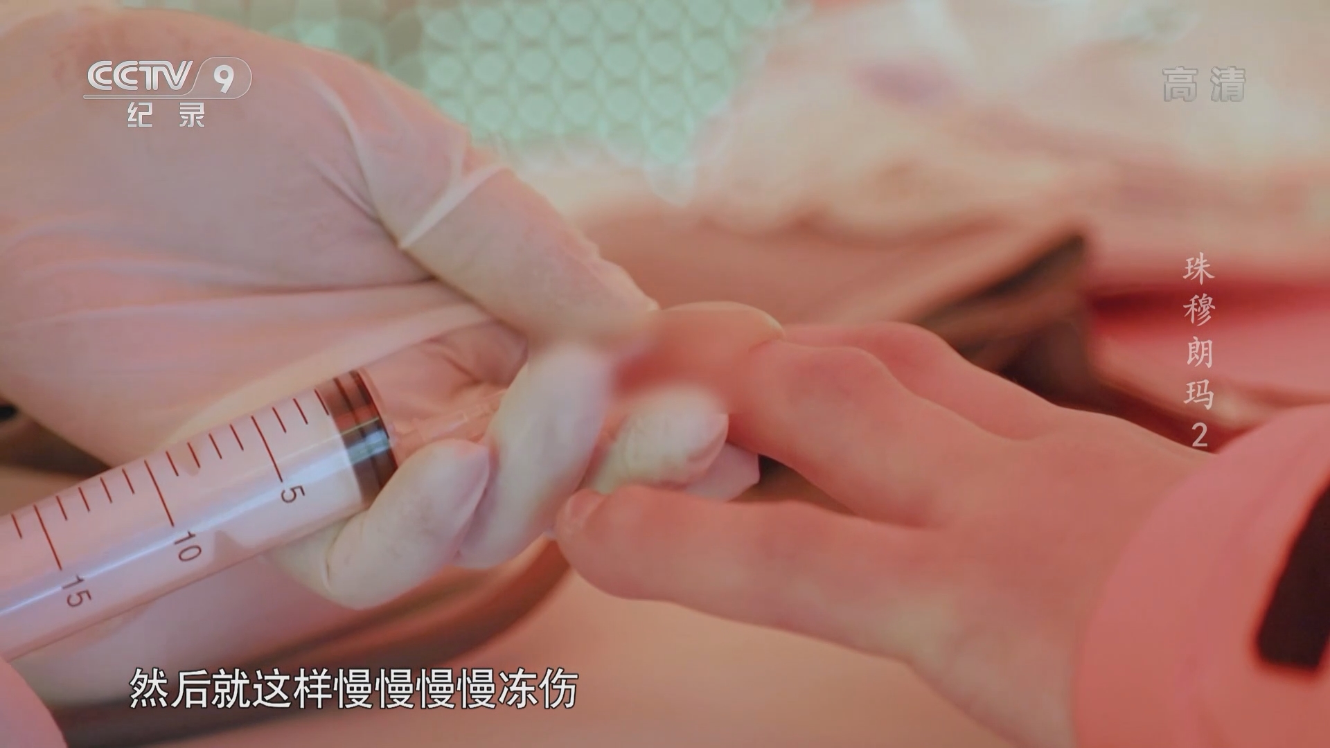 《珠穆朗玛》第2集：攀登珠峰最常见的身体伤害是冻伤