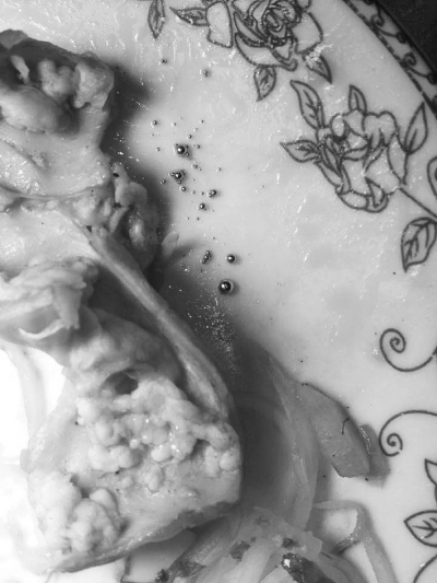 郑州市民吃肥肠流出一团水银 饭店称从未发生过