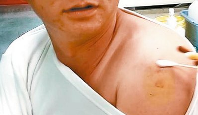 男子打针想自拍遭拒护理师：我的手是隐私（图）