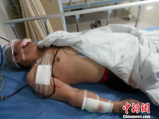 广西七旬老人乘公交车被司机持铁锤暴打