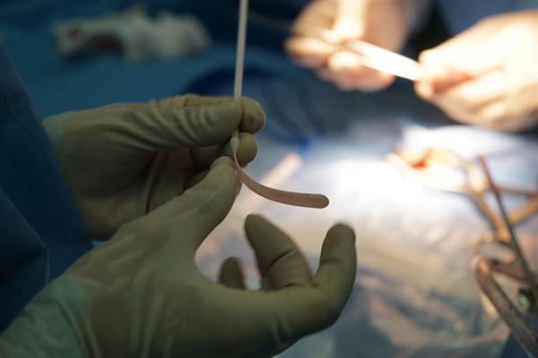 空军总医院采用新技术治疗腰椎术后顽固性疼痛