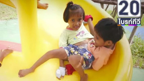 泰国连体姐妹共用双腿发明&ldquo;蟹式&rdquo;走路法（图）