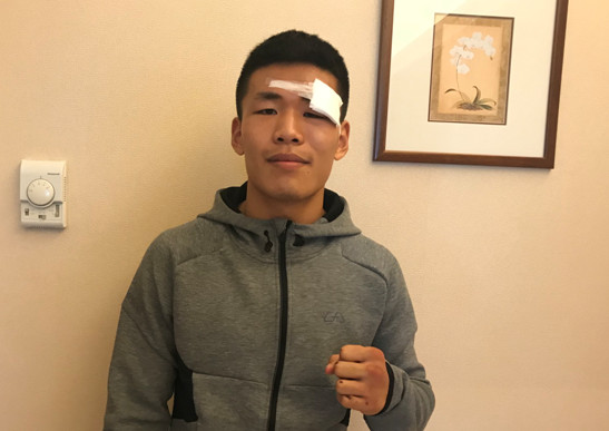 张成龙受伤缝14针 2018目标打进GLORY世界前