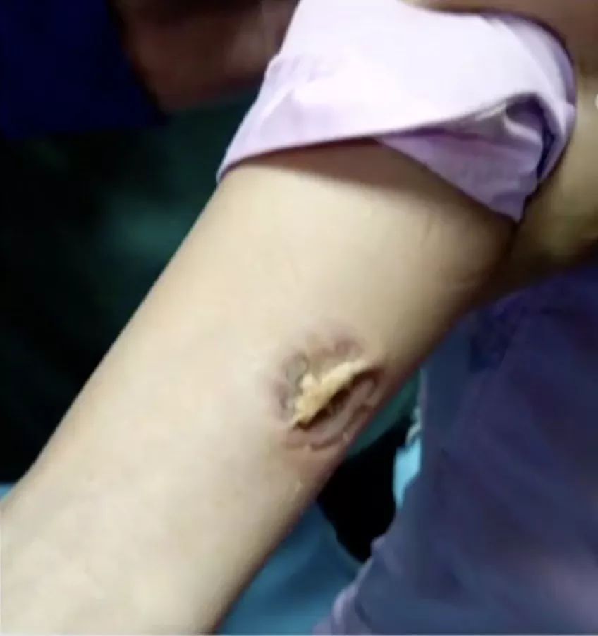 看着都觉得疼!可这位河南姑娘硬是忍着,坚持了3分钟……