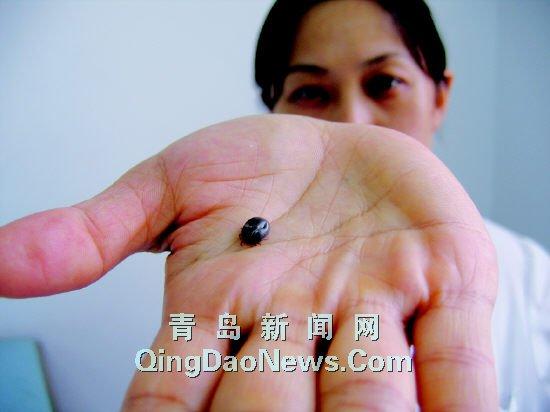 卫生部发布"蜱的特点及预防控制知识"