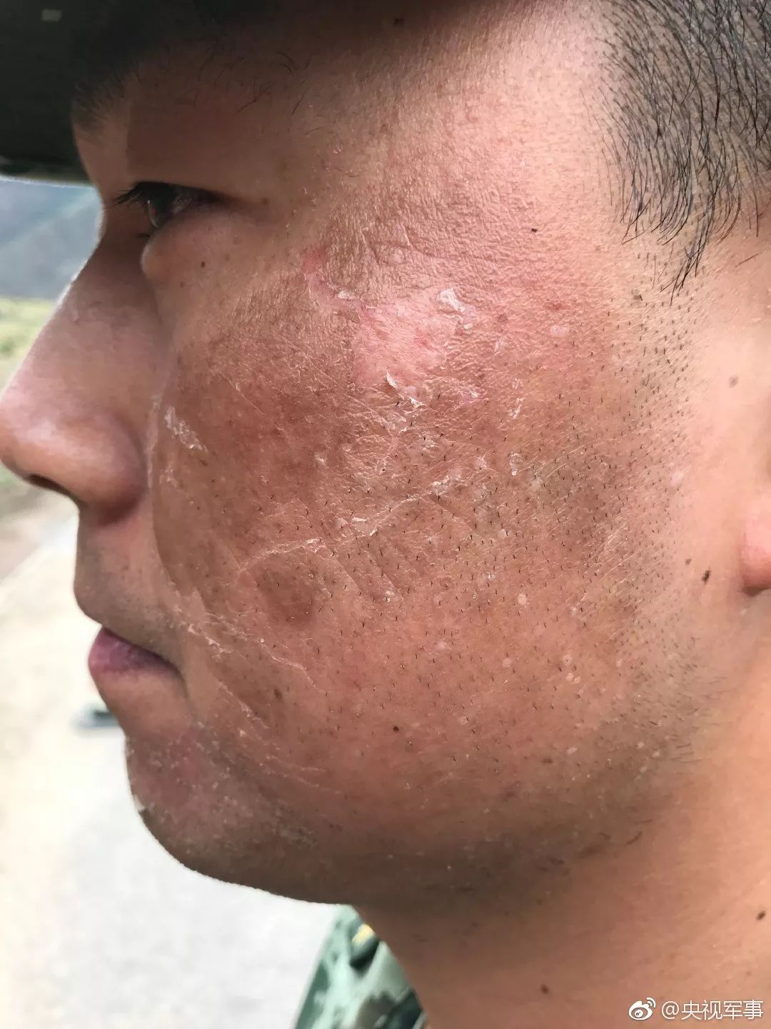 那是风沙吻的痕稀薄空气涂的斑西藏军人面部特写照被晒出