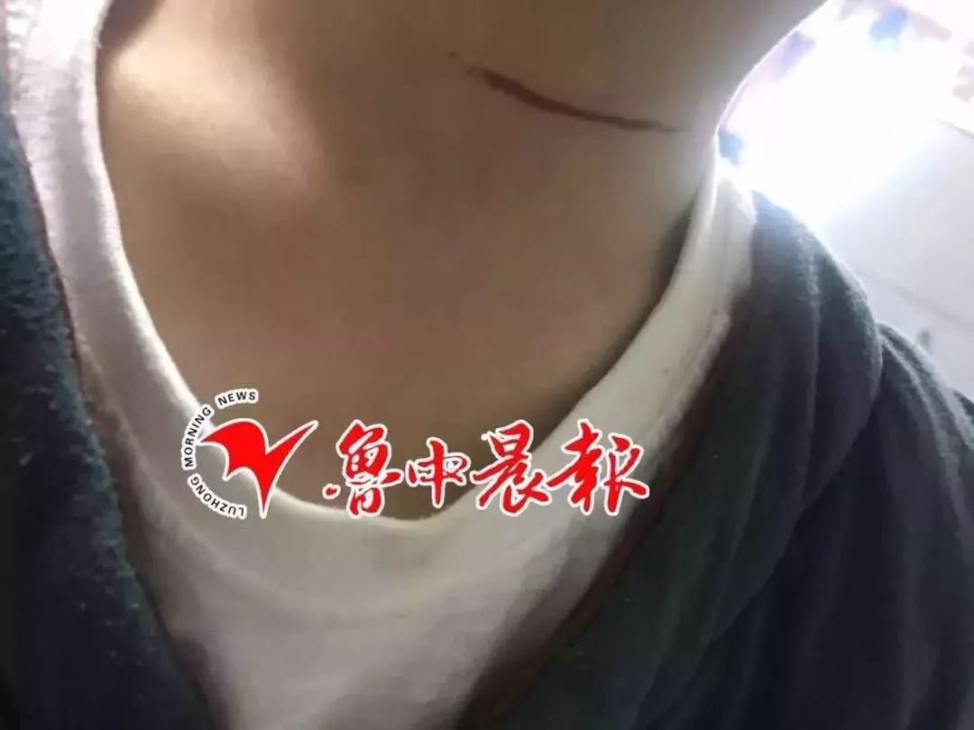 4岁女童被它割颈现在这东西很多出门当心