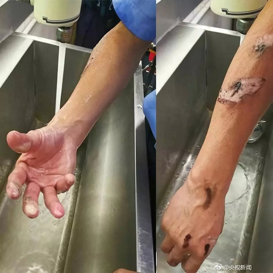 手_新闻_央视网(cctv.com)