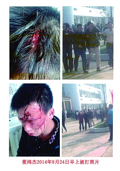 中学生出校门买早点被门卫打破头 警方介入调查