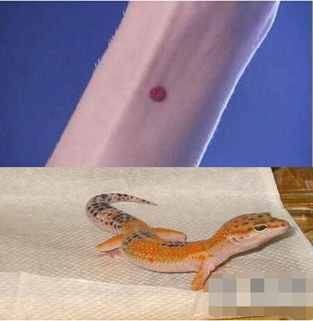 验证女子贞洁"守宫砂"制作流程 太多荒唐事