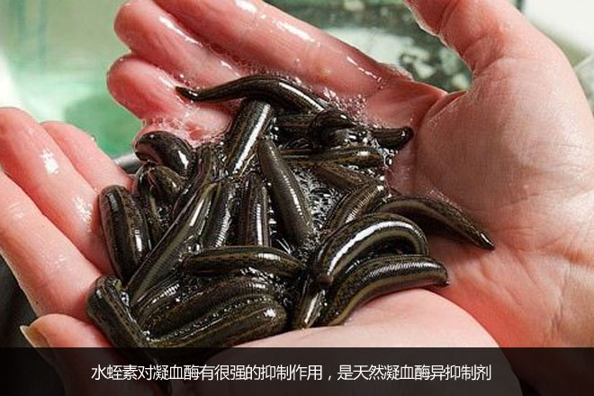 如何判断体内有水蛭 2015113017191446697.jpg