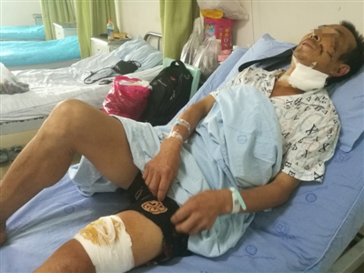 四川一村民疑遭黑熊袭击 面颊腮部伤口几乎穿透(图)