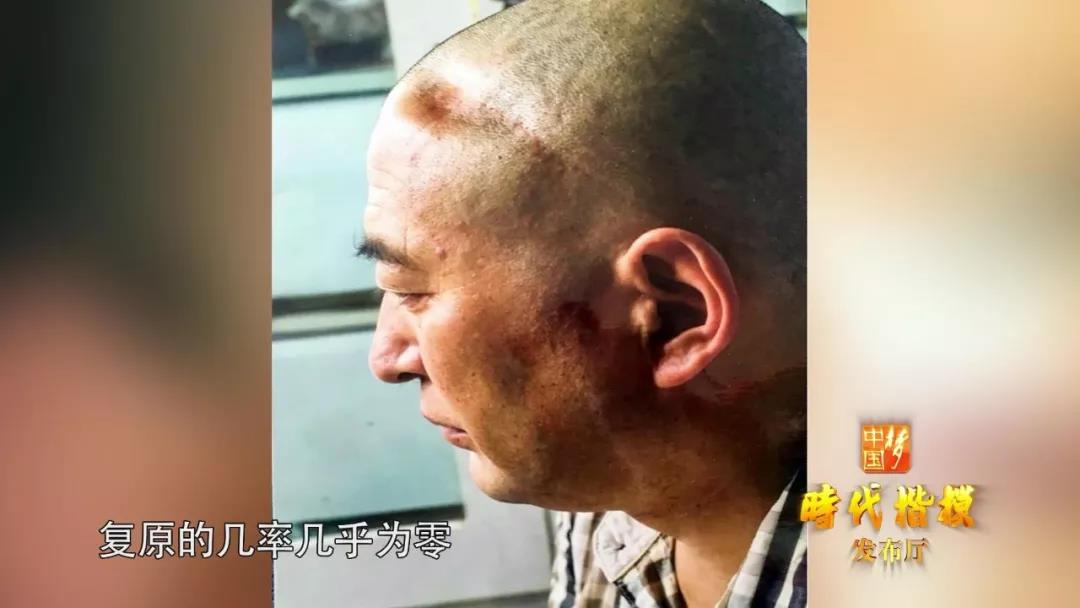 身中17刀手脚筋被砍断为了保护邮件这名康巴汉子拼了